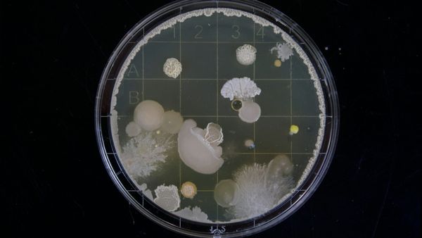 Parasitic Infections and Arthritis: The Dark Side