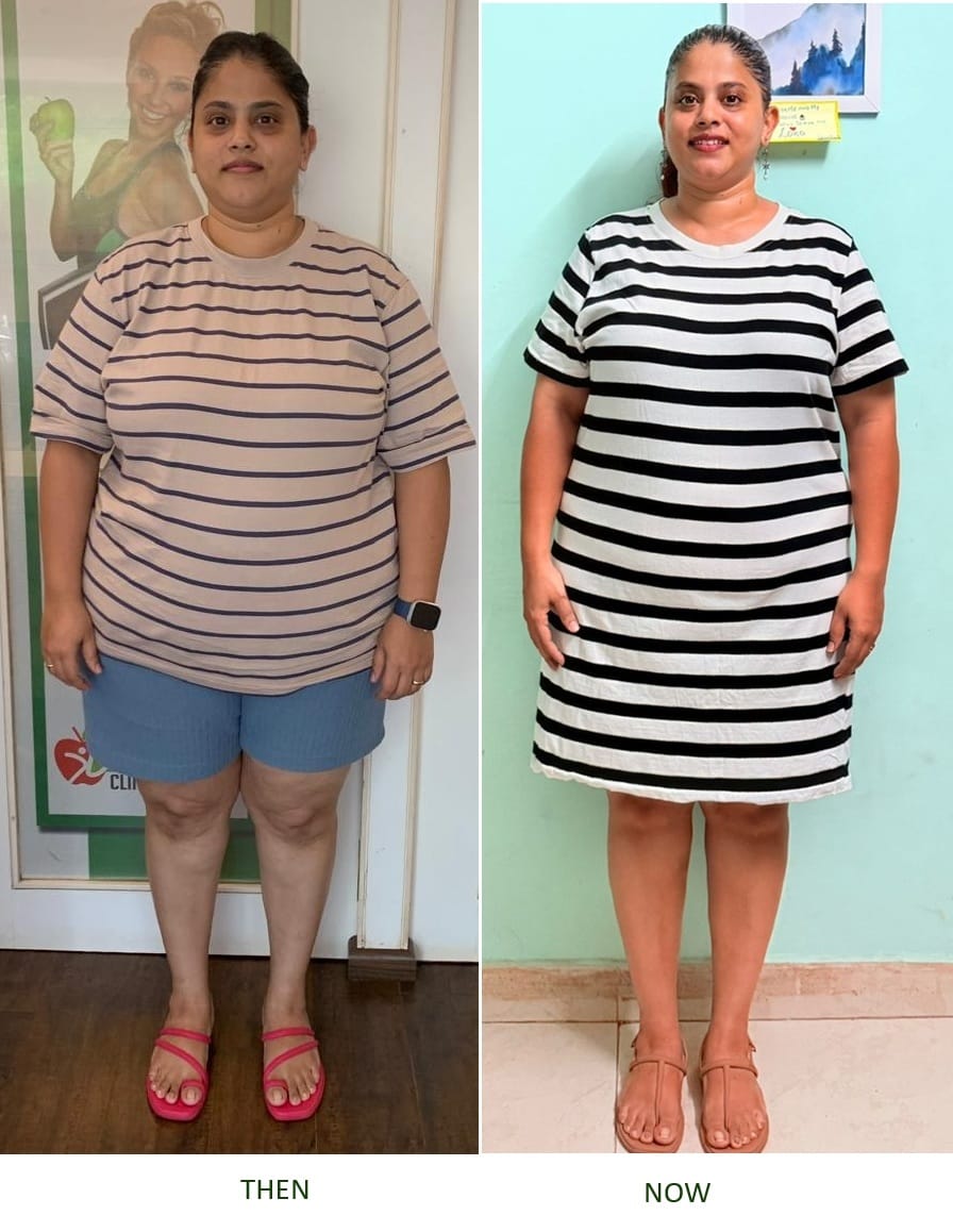 Samantha before and after front view - visible transformation after gut health protocol at Fuel It Right, Goa