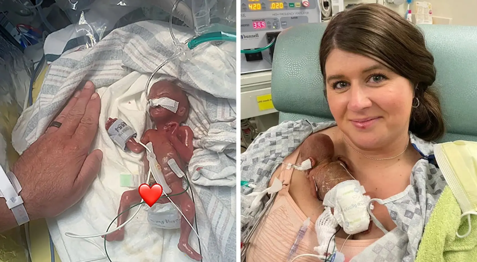 Bebé de Iowa Bate Récord Guinness como el Más Prematuro del Mundo al Nacer a las 21 Semanas