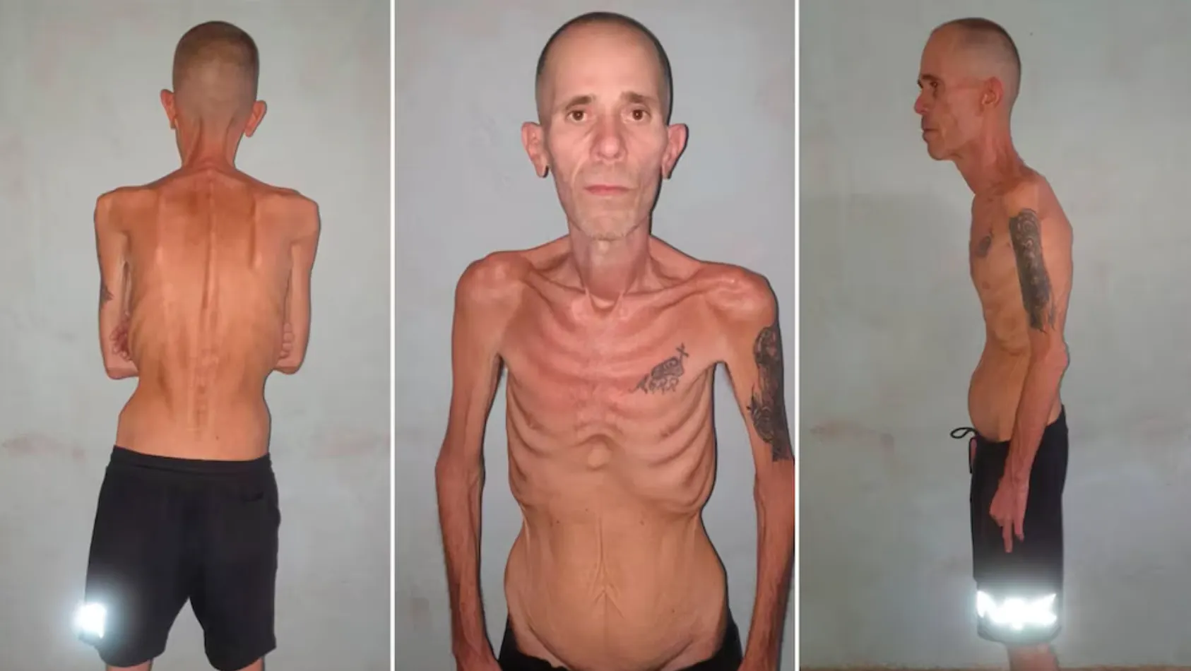 El horror del presidio castrista: Alexander Díaz sale de prisión reducido a los huesos tras cinco años de tortura