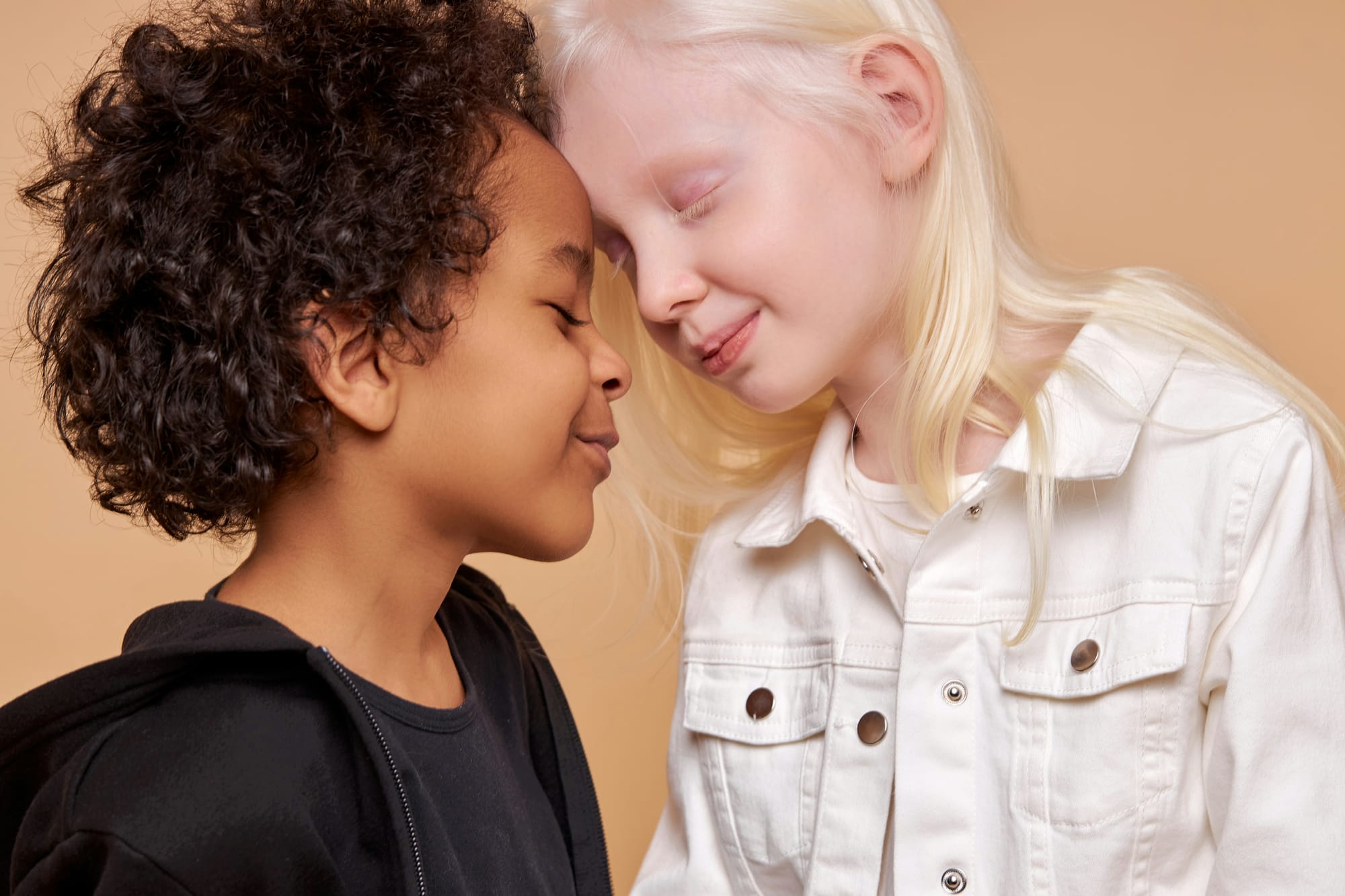 A brown-skinned child and an albino child touch foreheads, smiling. 