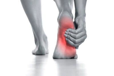PLANTAR FASCIITIS