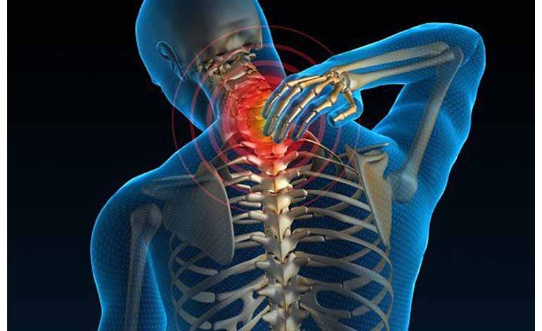 Cervical Spondylosis: Causes and Treatments