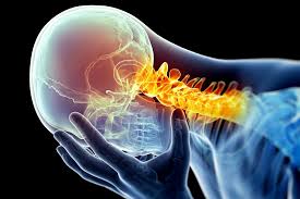 CERVICOGENIC HEADACHE: Causes and Treatment