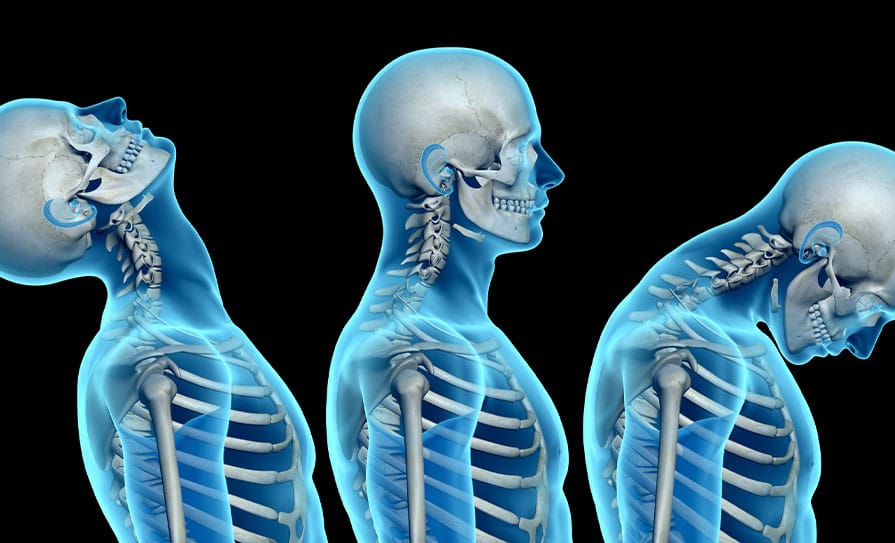 WHIPLASH ASSOCIATED DISORDER: Causes and Treatment