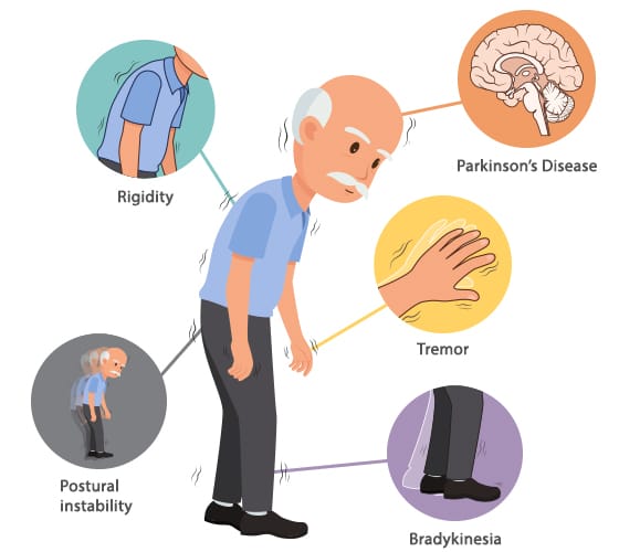 Parkinson`s disease: symptoms and Diagnosis
