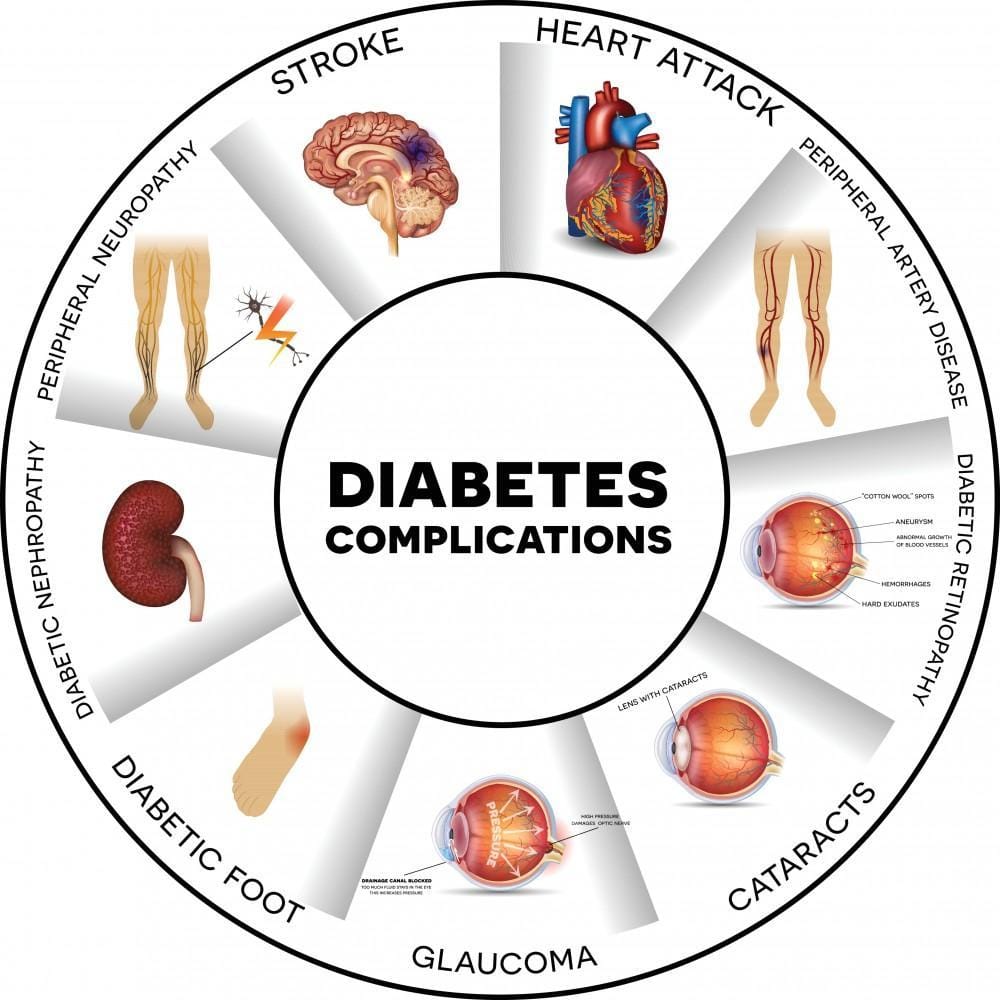 Diabetes diagnosis & treatment