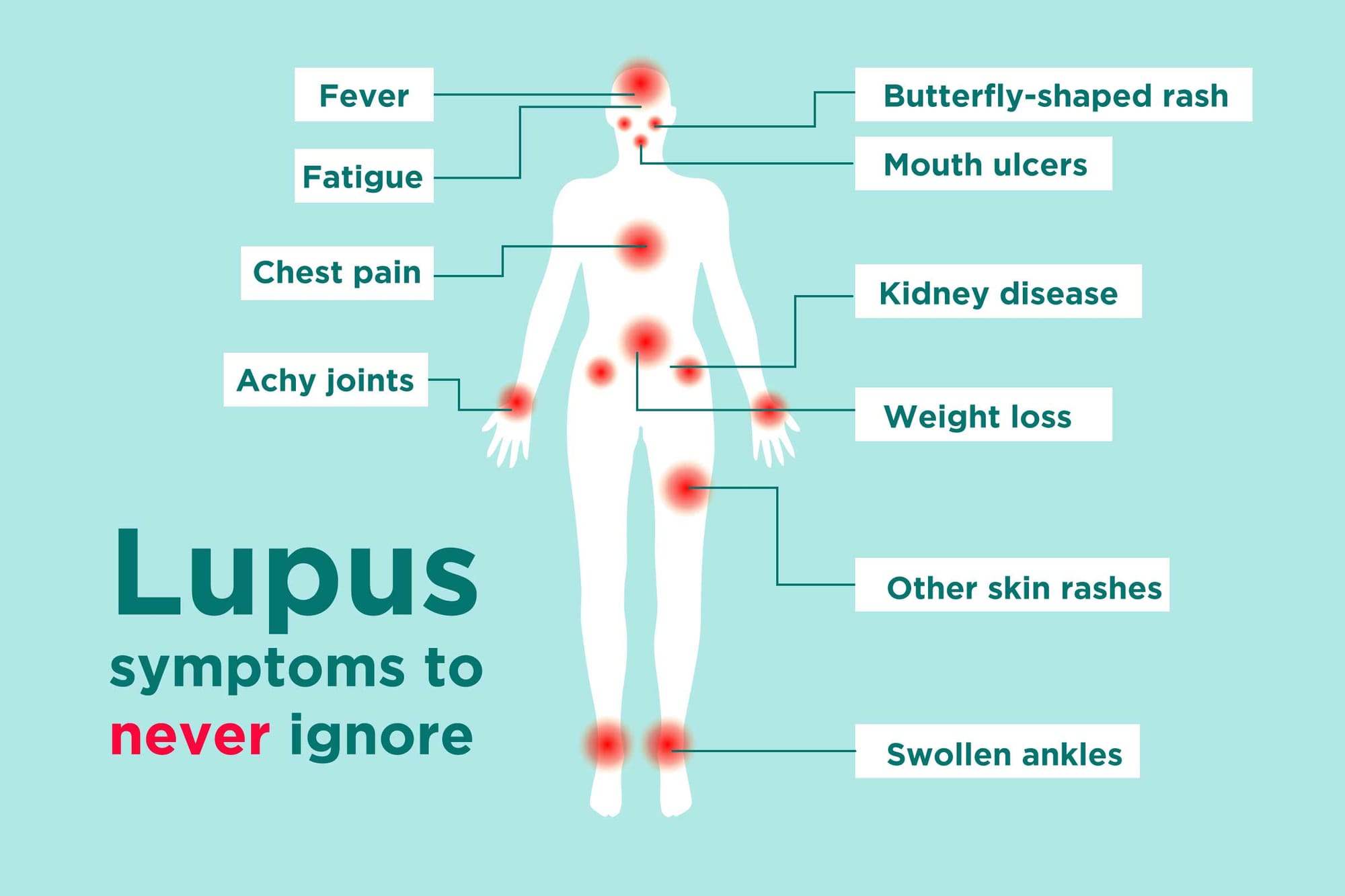 Systemic Lupus Erythematosus and Symptoms