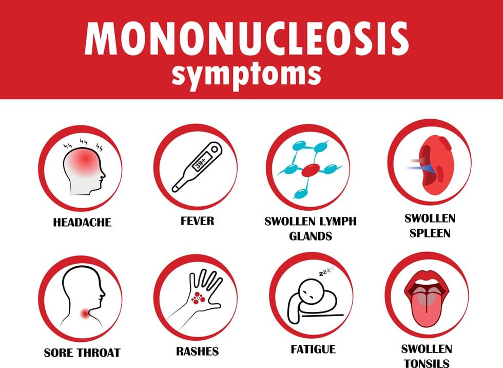 MONONUCLEOSIS and Symptoms