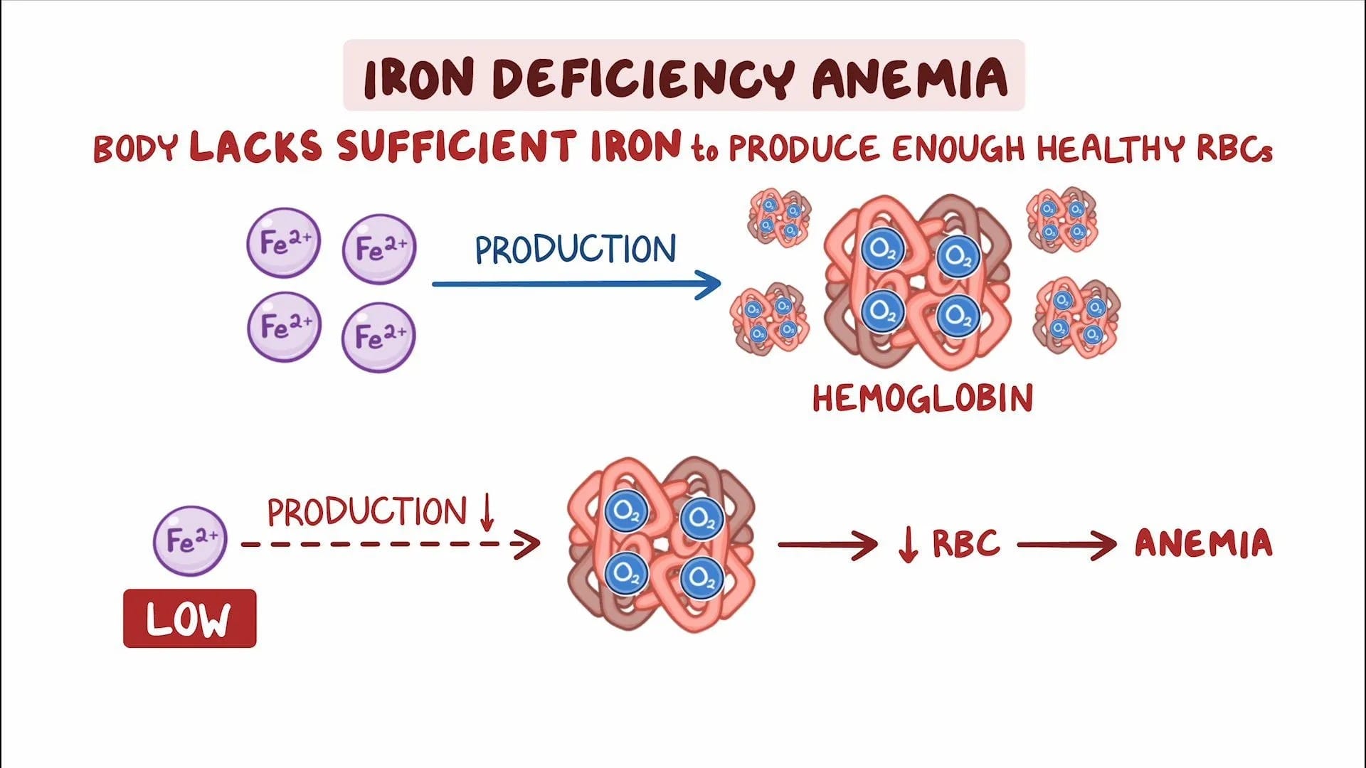 Iron Deficiency Anemia: symptom, diagnosis, and treatment