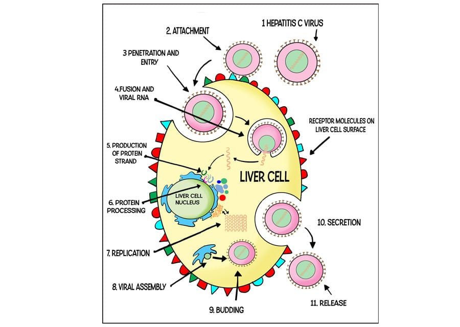 Hepatitis C: Causes, Diagnosis, and Treatment
