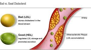Exercise to Improve Cholesterol