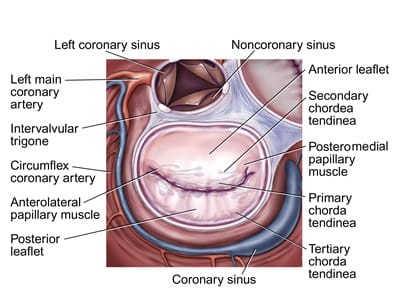 Mitral Valve Stenosis: Causes, Symptoms, and Treatment