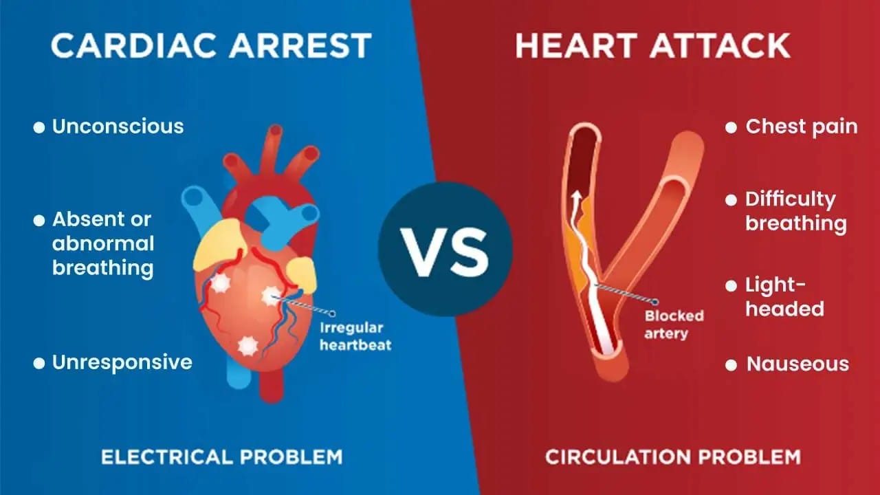 Cardiac Arrest: Causes, Symptoms, Diagnosis, and Treatment