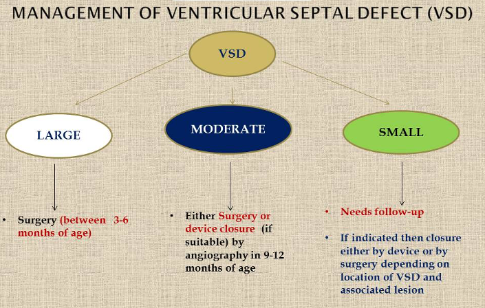 Ventricular Septal Defect: Causes, Diagnosis, and Treatment