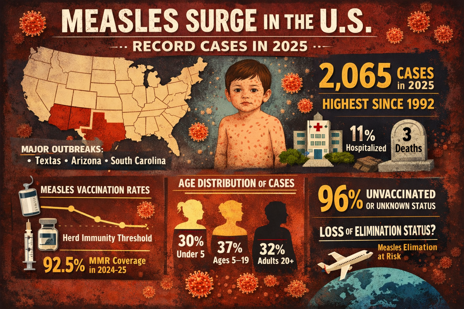 Measles Returns in Force as U.S. Records Highest Case Numbers in Over 30 Years