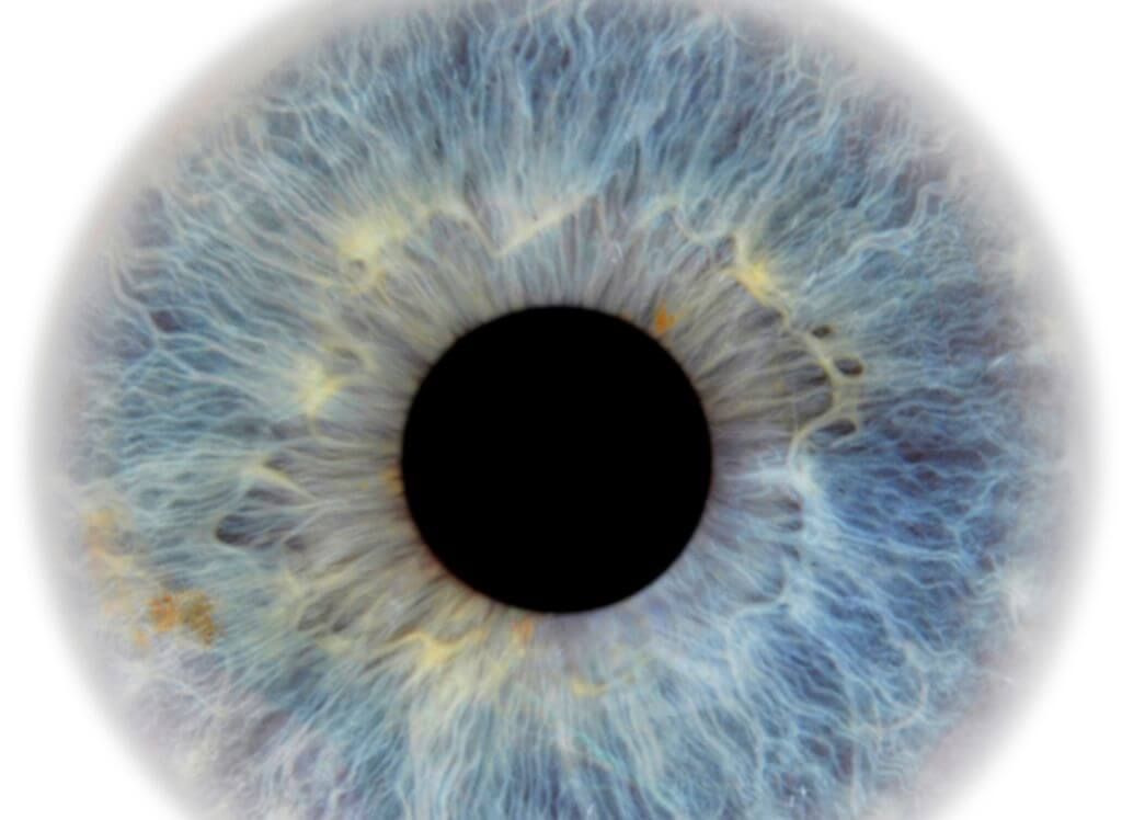 vitamins for eye floaters