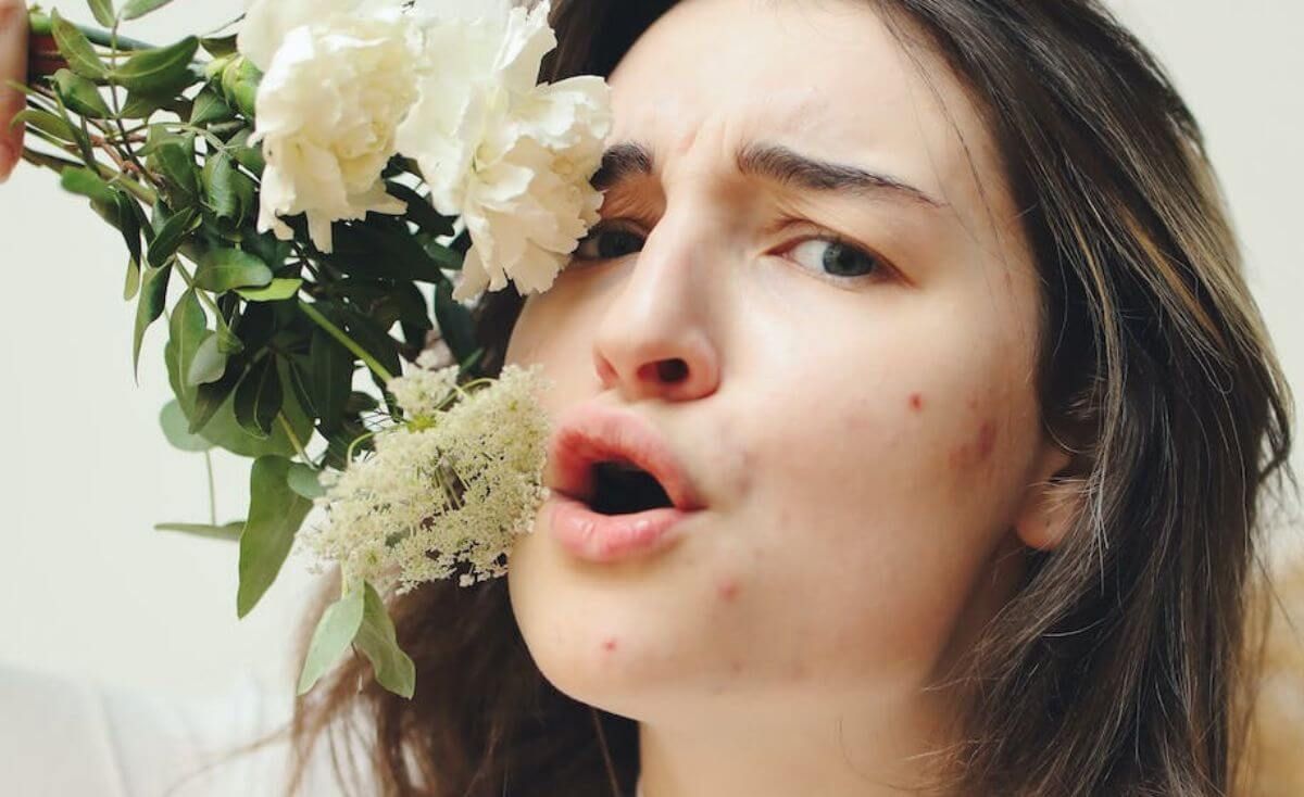 Pimple Patches