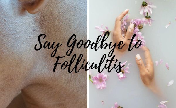 Beat Folliculitis Now: The Best Body Washes on the Market