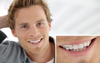 Potentially Hot Guy Spoils It By Smiling Enough To Reveal Blackmarket Nicotine Sachet
