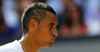 Kyrgios Vows To Debut An Even Shitter Haircut Against Murray