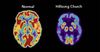 Scientists establish link between diminished brain function and Hillsong Church