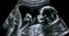 “We’ve Been Doing Some Rooting” Says Blurry Ultrasound Posted To Facebook