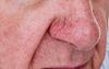 Cold Weather Really Bringing Out Local Alcoholic’s Nose