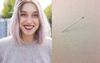 Millennials Begin Poking Needles Into Vacant Investment Properties To Drive Down House Prices
