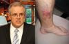 Nightwatchman Curses Shorten After Banging Shin On Coffee Table