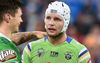 Johnneh Bateman Shows Croker How To Hide A Razor Blade On His Headgear Like Back In Uhngland