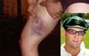 Mortal City Worker Wears Painful Reminder He Can’t Walk Across His Stumps Like Mark Waugh