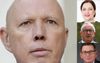 Dutton On International Arrivals: States Can Make Their Own Decisions, Which I Will Criticise