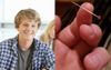 Classmate Confirms Chances Of Being Incarcerated Later In Life With Needle Through Skin Trick