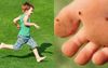 Barefoot Child Attempts To Navigate Lawn Full Of Bindis Like A Soldier Sweeping A Minefield