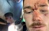 NSW Police Getting Itchy After Nearly 6 Months Without Assaulting A Canberra Raiders Player