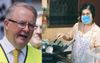 Albo: “Only Pay With Cash When Supporting Local Restaurants, Scotty’s Taken Enough From Them”