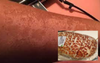 Woman With Fake Tan Addiction Reckons Looking Like Woolies Tiger Bread Is Better Than Being Pale