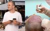Balding Mate Pretty Vague About Why He’s Incorporating Türkiye Into His Euro Trip