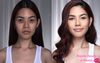 Cosmetic Clinic Advertising ‘Snatched’ Results Makes Sure Before Shots Are Taken In Worst Lighting Possible