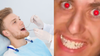 “You Must Grind Your Teeth In Your Sleep” Says Dentist, Unaware They’re Talking To The King Of The Sesh
