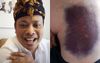 Australia Outraged And Demanding Answers After Ketut Is Shot In The Arse With A Rubber Bullet