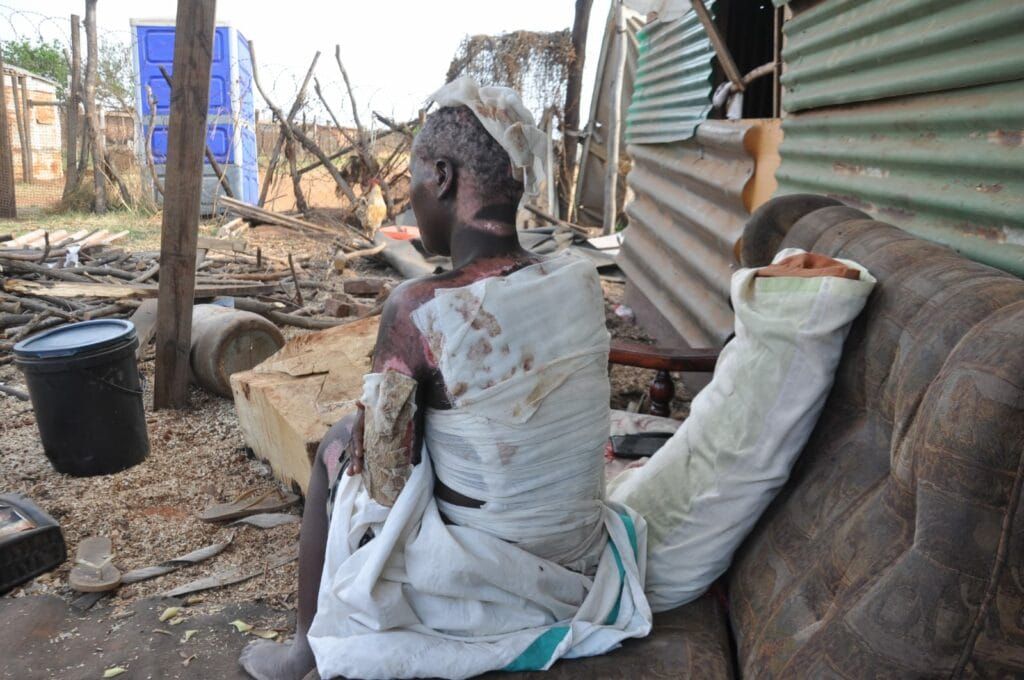 Victims of Daggafontein Mine Raid Accuse Police of Downplaying Incident