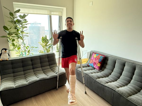 7 Days Out from Ankle Surgery