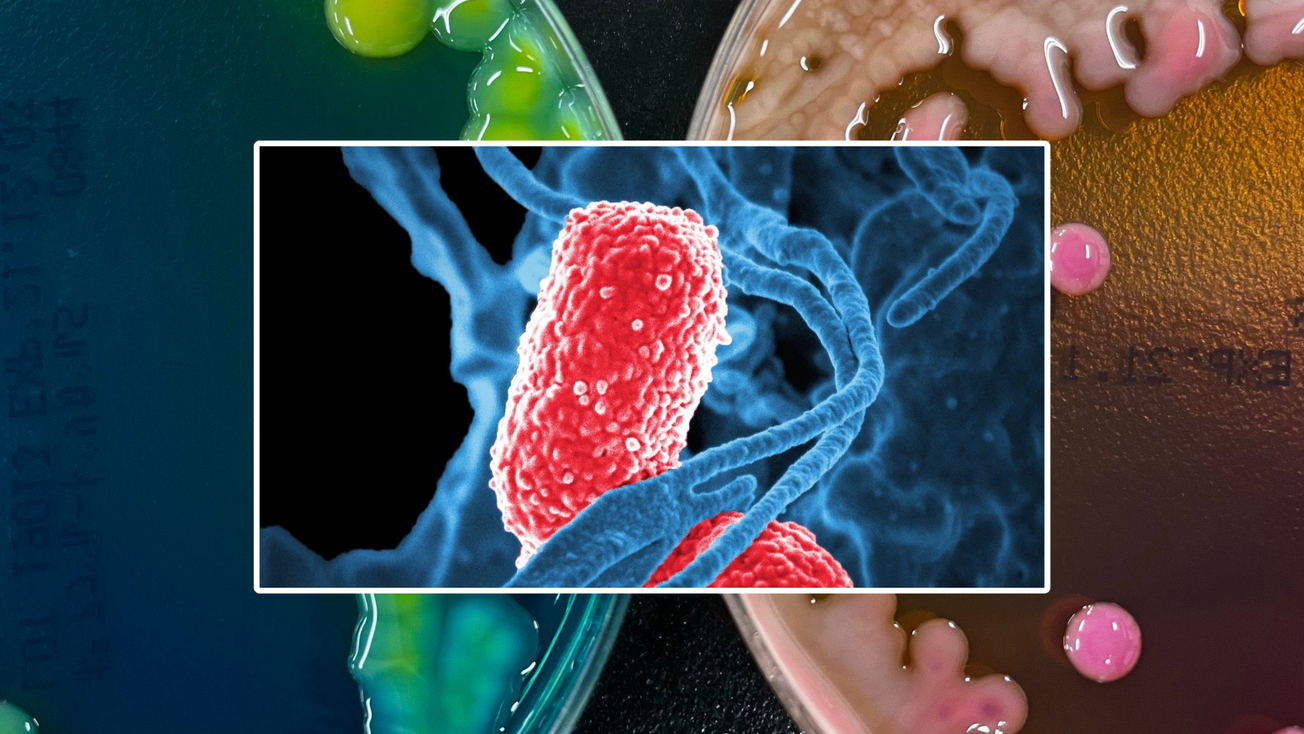 Qué es la bacteria Klebsiella y por qué ha generado alerta en México: síntomas