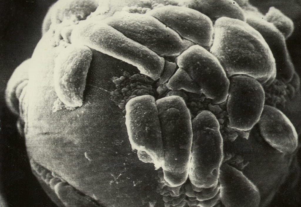 01 - Bacteria in Space?