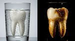 Bubble Trouble: The Anatomy of the Myth That Sparkling Water Is Ruining Your Teeth