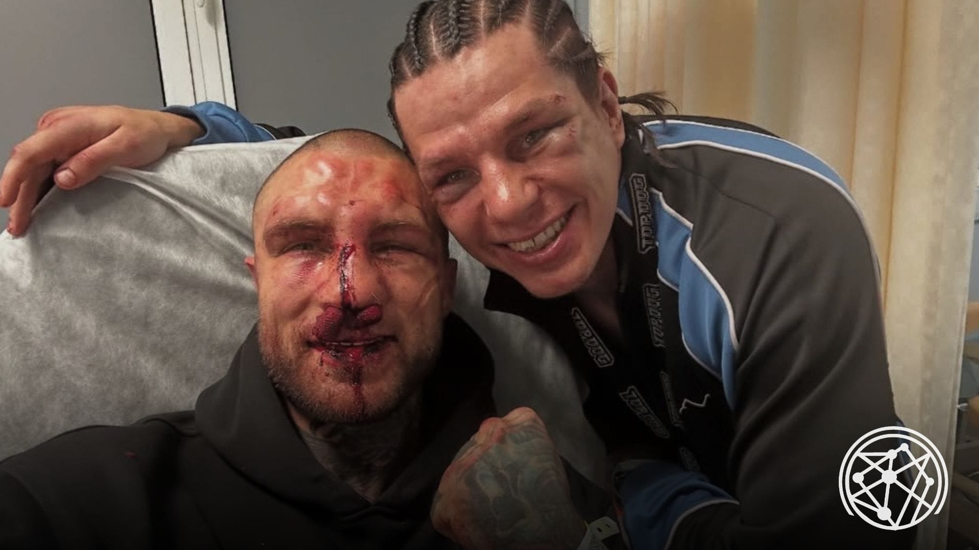 Alex Terrible Loses by Decision in Gruesome 2nd Bare Knuckle Boxing Fight: Top Dog 37 | The Metalverse.net