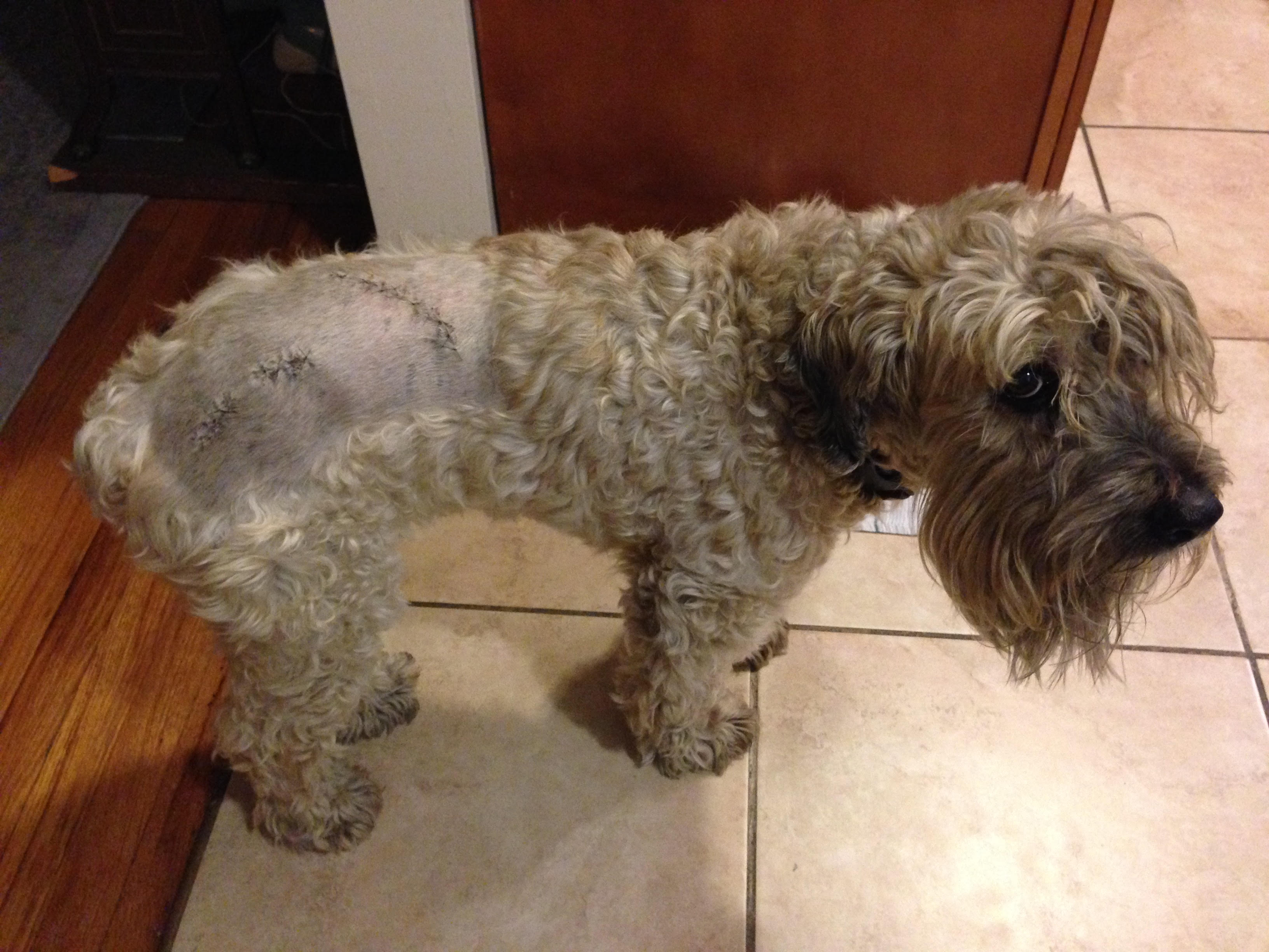 Ella's stitched incisions from cyst-removal surgery