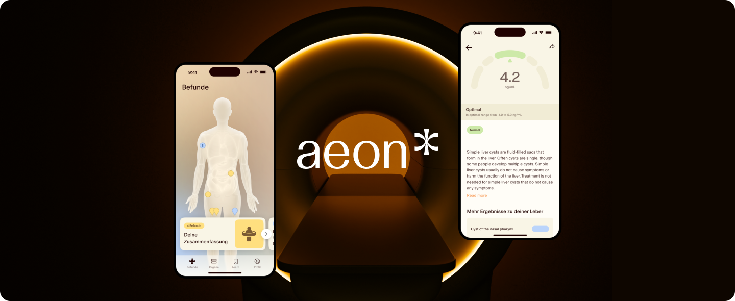 Mobile App von aeon auf zwei Smartphone Bildschirmen